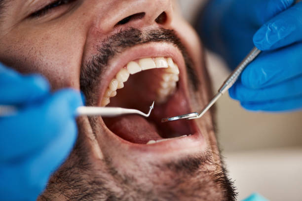 Best Cosmetic Emergency Dentistry in Hoffman Estates, IL