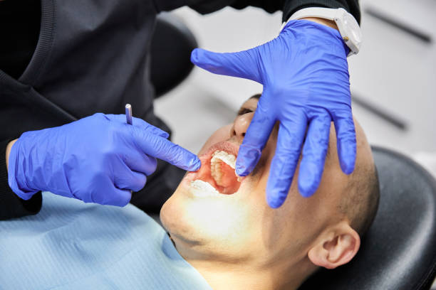 Best Emergency Tooth Extraction in Hoffman Estates, IL