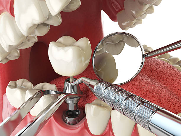 Best Emergency TMJ Treatment in Hoffman Estates, IL