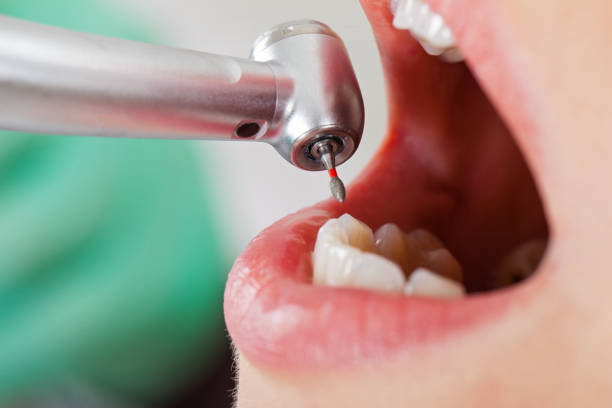 Best Emergency Gum Treatment in Hoffman Estates, IL